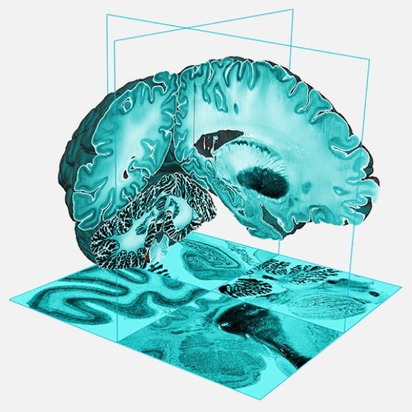 HIBALL Brain Depiction