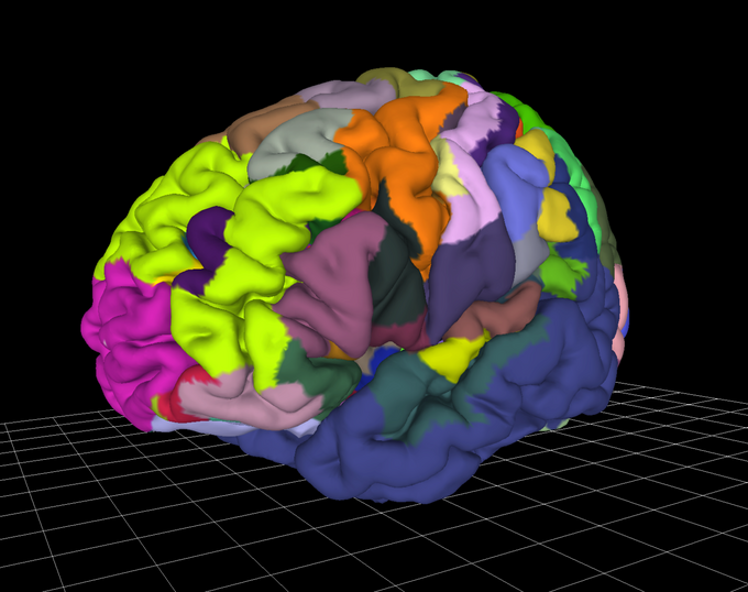 Image showing a human brain with different brain areas highlighted in different colors