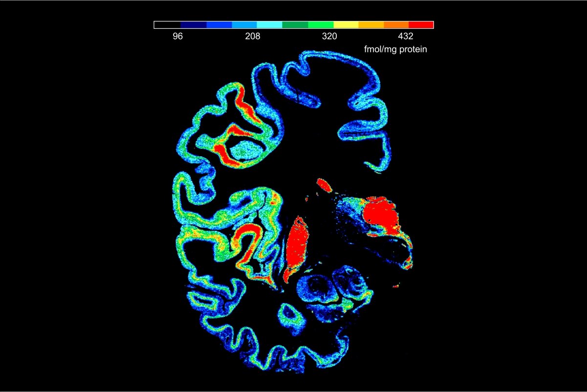 Density map of the cholinergic muscarinic  M2 receptor