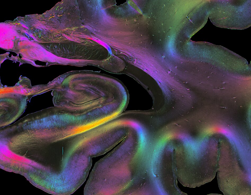 Fibre architecture of the human hippocampus. Detail of a human brain section showing the architecture of fibres down to single axons in the hippocampus, revealed by 3D Polarized Light Imaging. Colours represent 3D fibre orientations highlighting pathways of individual fibres and tracts. 